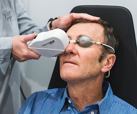Use of IPL (Intense Pulse Light) in dry eye